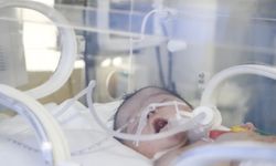 Doğunca nefessiz kalacaktı, annesiyle bağı koparılmadan ameliyat edildi