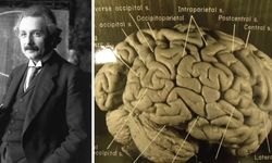 Albert Einstein'ın beyninin öldükten sonra çalınması