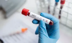 HIV'in tedavisi ve toplumsal damgalama: Doğru bilinen yanlışlar