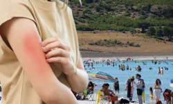 Türkiye’de et yiyen bakteri alarmı! Bakanlıktan açıklama