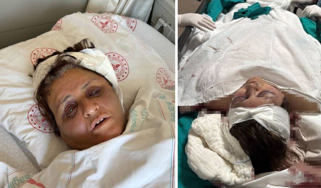 İzmir’de şok eden olay! Gelin, kayınvalidesini tuğlayla dövdü