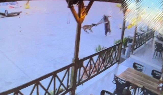 Tekmelere aldırmayan köpek kadının kolunu kopardı