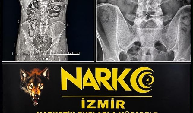 Havalimanında şüpheli yolcuların midesinden uyuşturucu çıktı