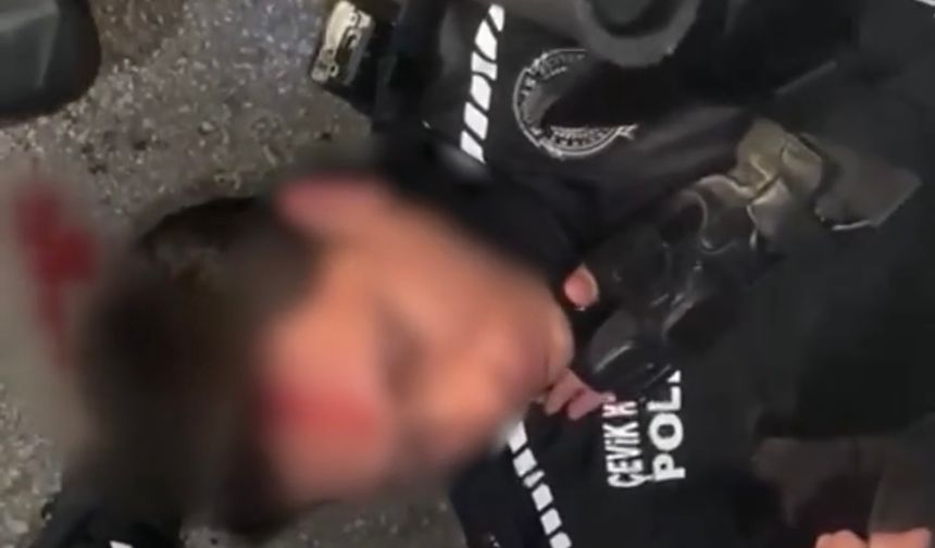 SON DAKİKA: Ankara’da göstericilerden polise baltalı saldırı!