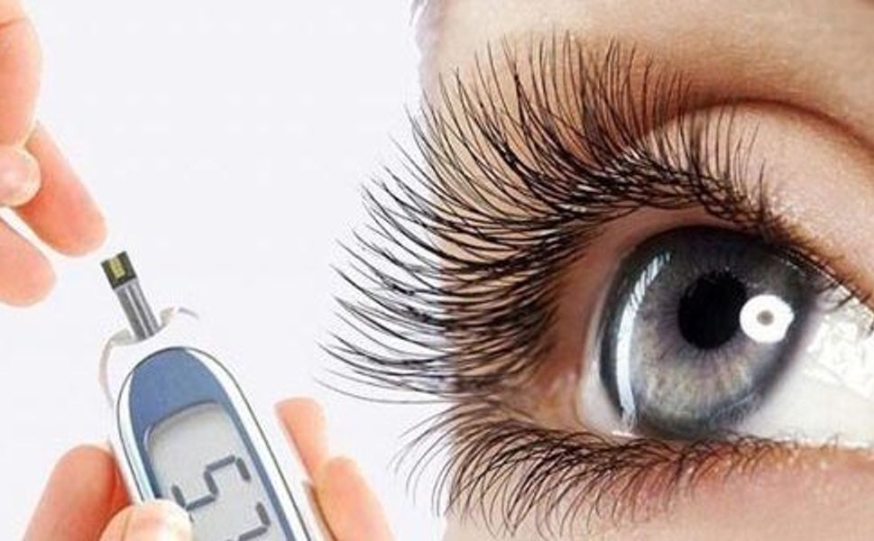 Diyabetik Retinopati Gözleri Vuruyor