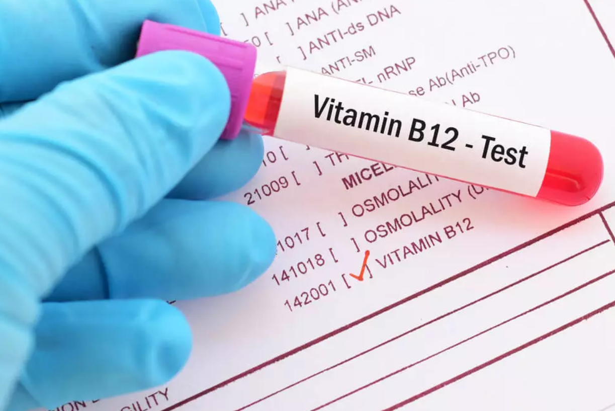 B12 Testi