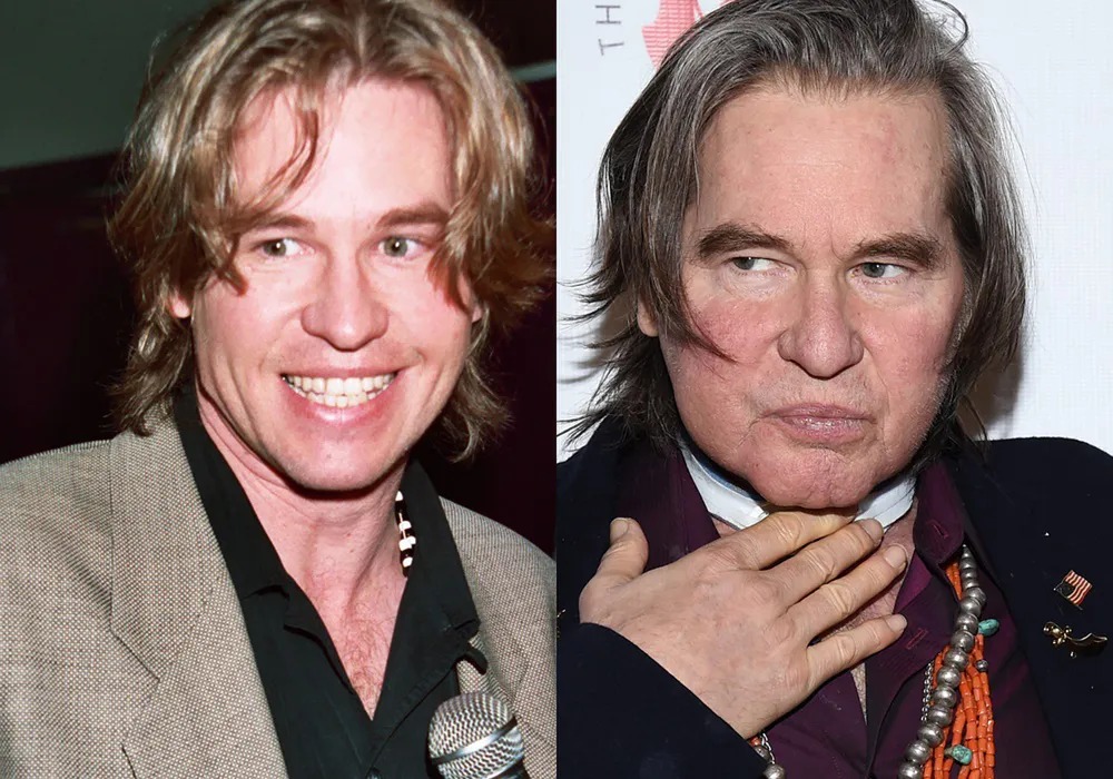 Val Kilmer